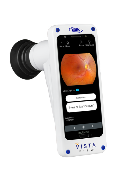 VistaView™ Mydriatic Portable Fundus Camera