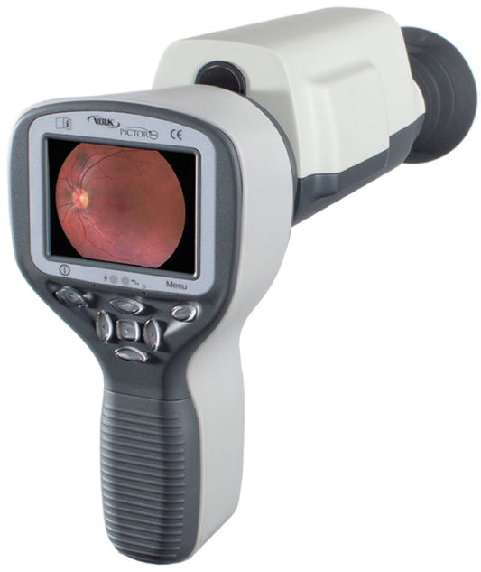 Pictor Plus™ Fundus Camera