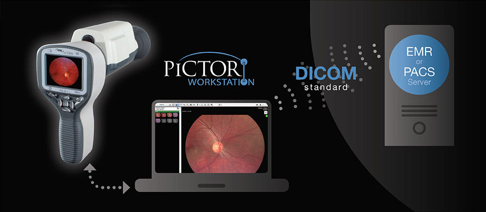 Pictor Plus™ Fundus Camera